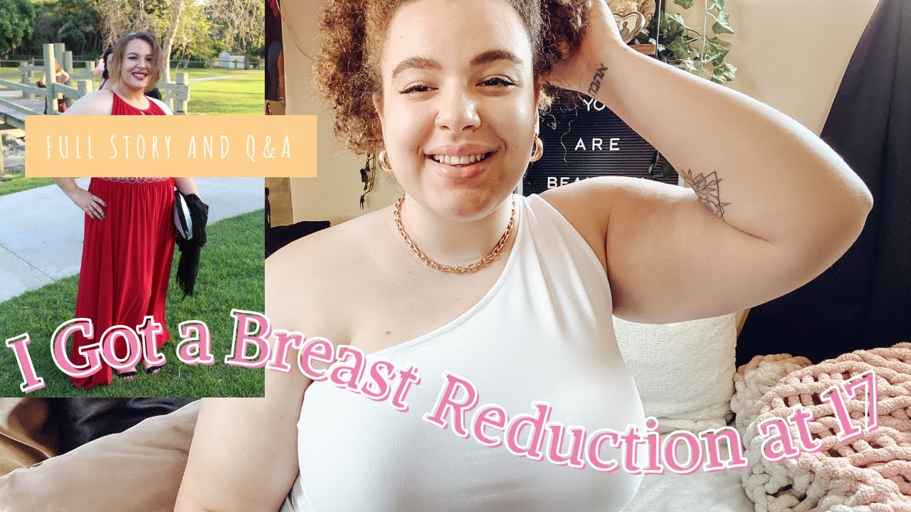 I Got a Breast Reduction at 17: 4-Years Post Op!