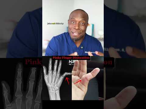 Bone Fracture vs