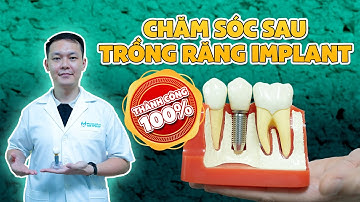 [HÉ LỘ] 7 Lời Dặn Quan Trọng Sau Khi Trồng Răng Implant