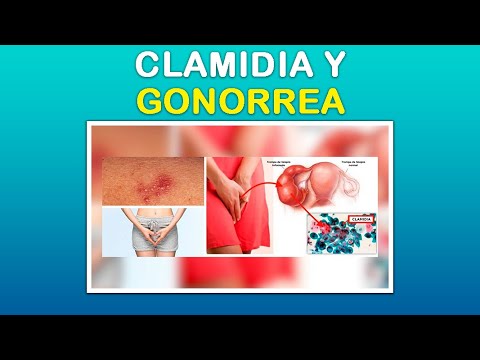 Que infusión es buena para la infección de orina