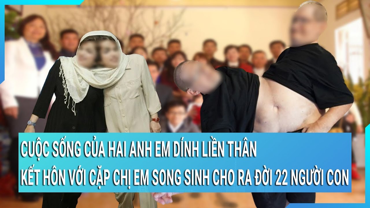 Cuộc sống của hai anh em dính liền thân kết hôn với cặp chị em song sinh cho ra đời 22 người con