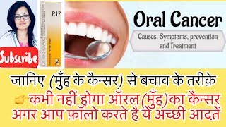 Oral(Mouth )Cancer- Best Homeopathic Medicine For Cancer  ?मुँह का कैन्सर- ?Homeopathic Treatment