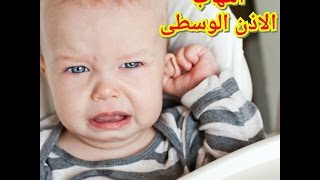 التهاب الأذن الوسطى - الأعراض الأسباب والعلاج- Otitis media