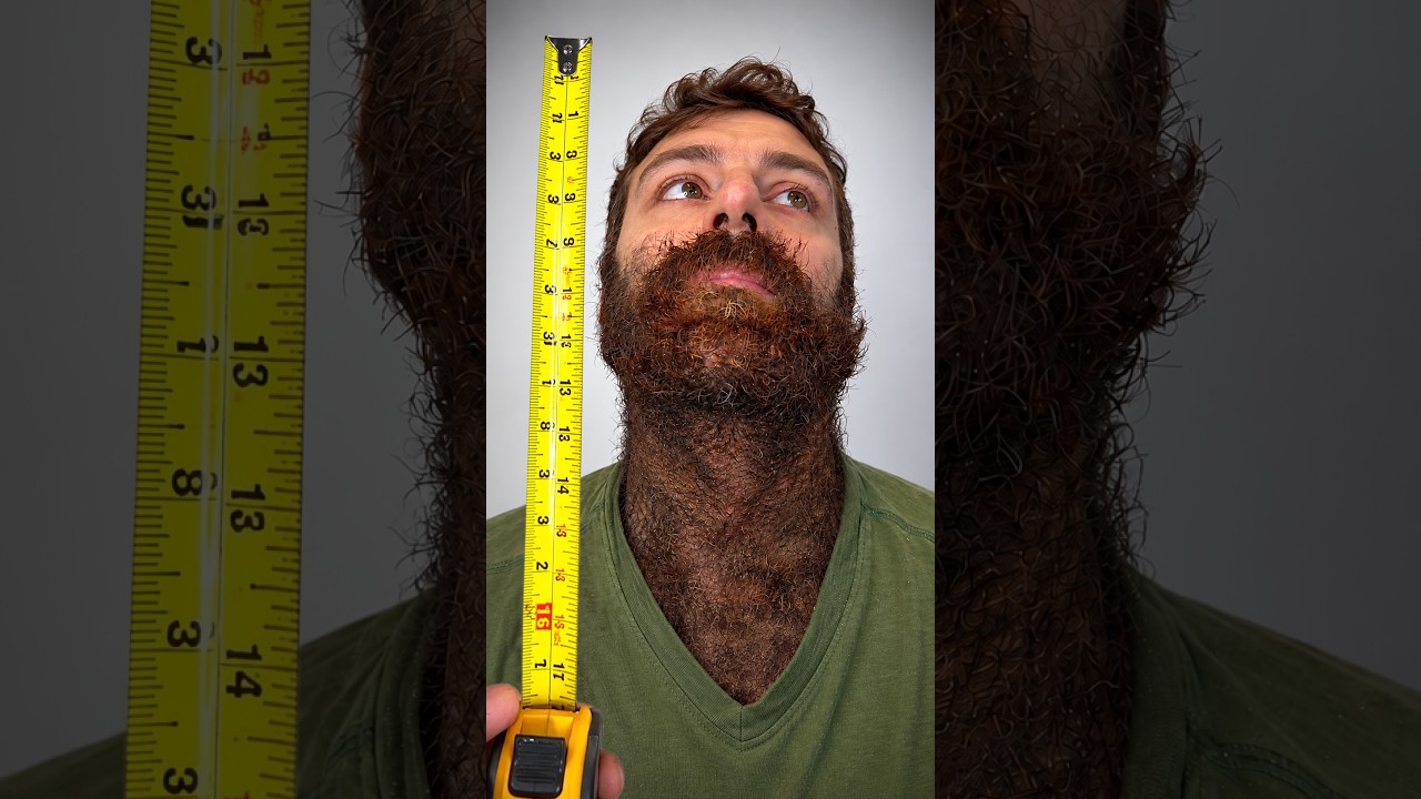96% of his body is covered in hair
