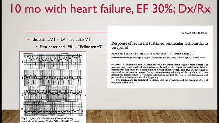 Mount Sinai Pediatric EP Conference 5.9.22