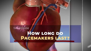 How long do Pacemakers last?