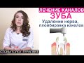 Как лечат каналы зуба - удаление нерва из зуба, пломбирование каналов зуба. Длительность лечения.