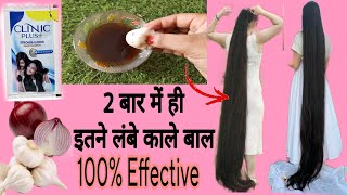 2 बार में ही इतने लंबे काले बाल / 100 % effective remedy for hair growth ♥