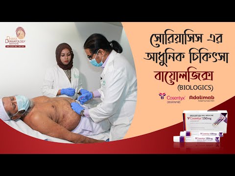 ভিডিও: সোরিয়াসিস নির্ণয়ের W টি উপায়