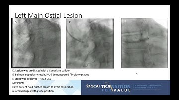 Module 9, Left Main and Bifurcation Lesion PCI with TRA Access