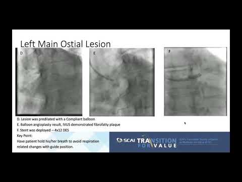 Vídeo: MANEIG DE LESIONS: FINESTRA TERAPÈUTICA