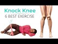 6 Best knock Knee Correction Exercise in Hindi