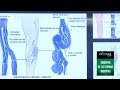 Cómo identificar el síndrome de piernas inquietas