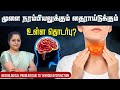 மூளை நரம்பியலுக்கும் தைராய்டுக்கும் உள்ள தொடர்பு | Neurological Problem due to Thyroid dysfunction