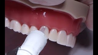 Class V GIC/Resin Composite Cavity Preparation & Restoration