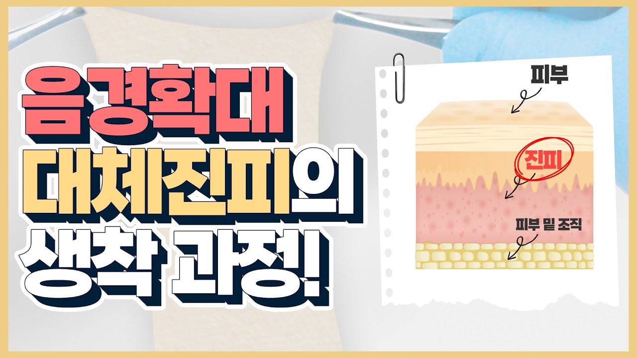 진피의 종류와 생착과정 : 대체진피?, 저장진피?, 동종진피? 이종진피? - YouTube