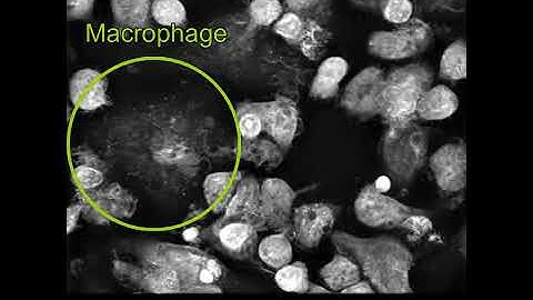 Label-free Live Cell Imaging: APC T-cells interaction/activation experiment