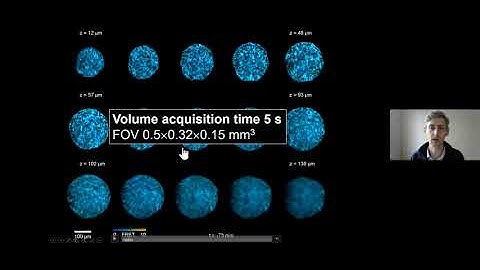 Chris Dunsby - Oblique Plane Microscopy - Imaging ONEWORLD