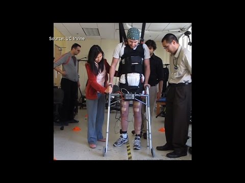 Video: Paralysis-inducing Spinal Cord Disease Sa Mga Pusa
