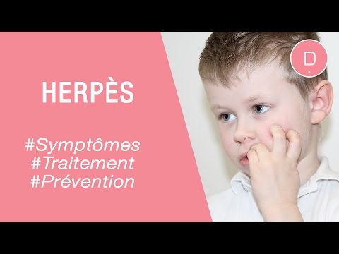 Vidéo: Herpès Chez Les Enfants - Symptômes, Traitement, Herpès Sur Le Corps, Les Lèvres, La Gorge