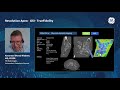 Deep learning reconstruction in ct and mr a game changer