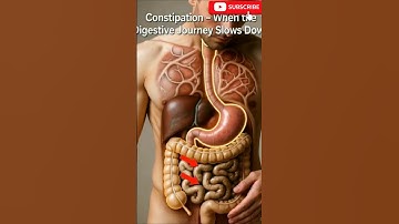 Realistic Human Anatomy Visualization Severe constipation #3danimation  #science  #shorts