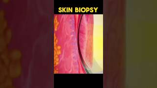 skin biopsy procedures viral shorts