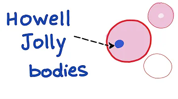 How Howell-Jolly bodies are formed?