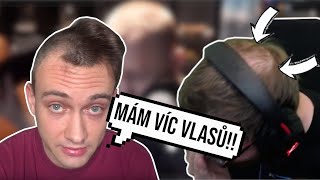 Haha Žalude, kde máš vlasy?? :) | COŽE #3