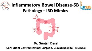 IBD mimics - Crohn's disease and Ulcerative colitis mimics on biopsy - Inflammatory bowel disease 5B