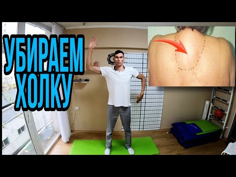 Как убрать холку на шее Жировик How to Get Rid of a Neck Hump