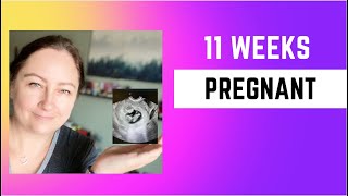 11 WEEKS PREGNANCY UPDATE: 2nd Prenatal Appt and subchorionic hematoma by T&G Life 69 views 11 months ago 7 minutes, 19 seconds
