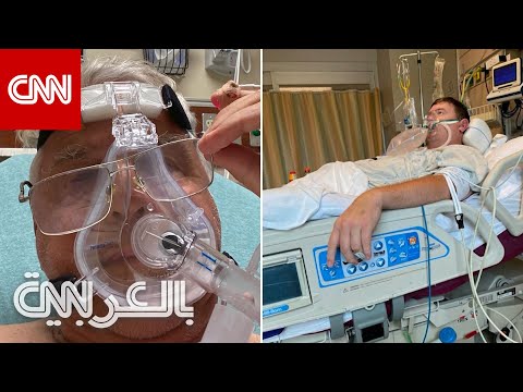 فيديو: وفيات بسبب فيروس كورونا. يشرح الدكتور شتشيبان كوفتة من يقتل الفيروس غالبًا [WIDEO]