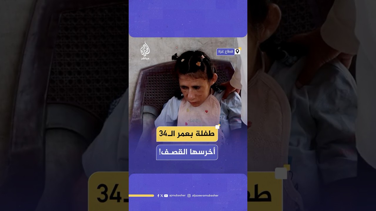 طفلة بعمر 34 عاما في غزة.. أنهكها المرض وأخرسها القصف