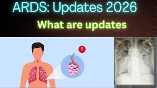 Acute Respiratory Distress Syndrome: Updates 2026: What has updated & every intensivist should know
