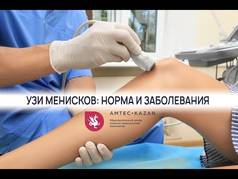 Узи менисков: норма и заболевания