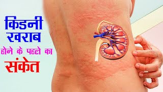 किडनी ख़राब होने के 5 संकेत | kidney problems symptoms in hindi | kidney disease | Kumar’s Ayurvedic