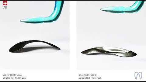 Comparison of elastic memory QuickmatFLEX sectional matrix vs. stainless steel sectional matrix