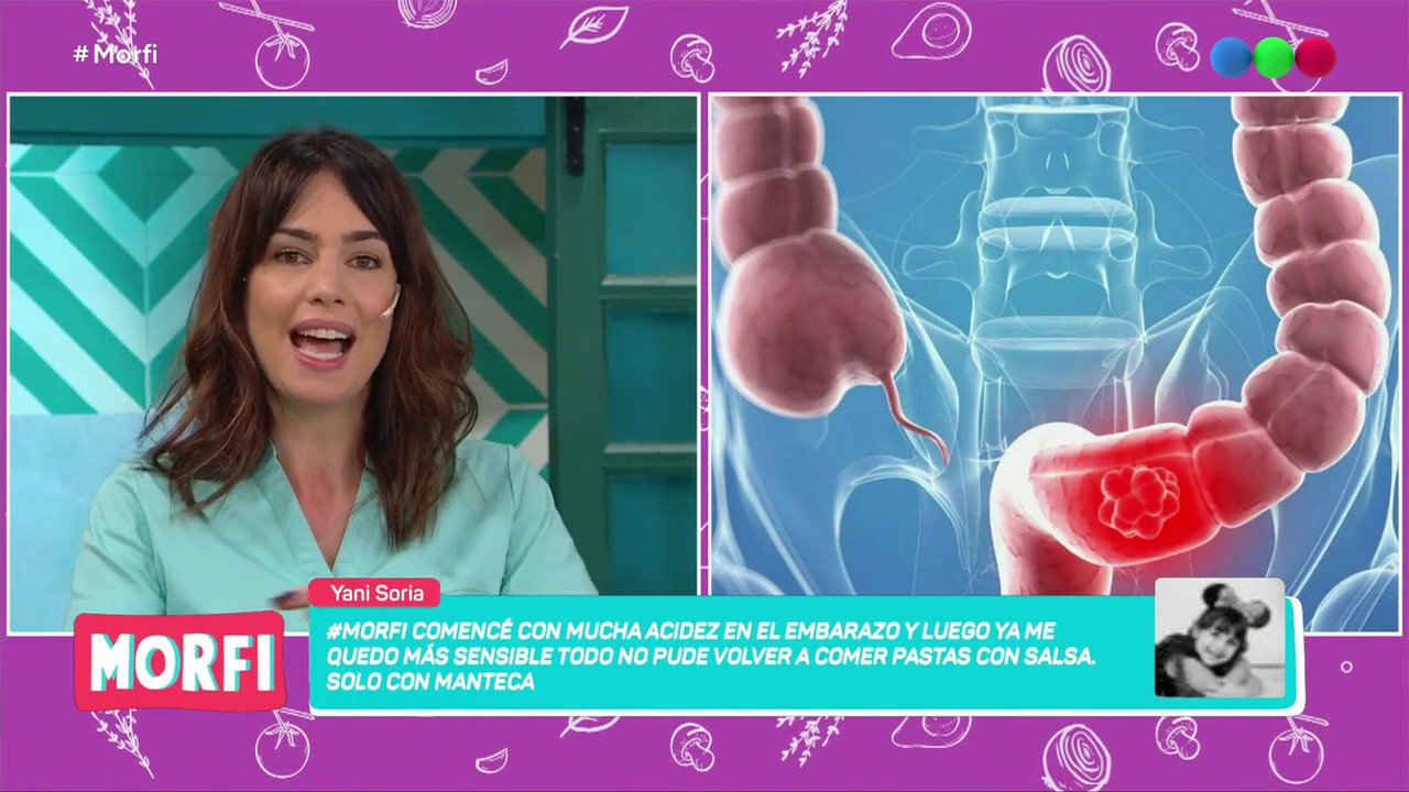 Sindrome del colon irritable y embarazo Sindrome del colon irritable y embarazo