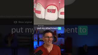 Where should you place the attachments? Snippet from the last Q&A