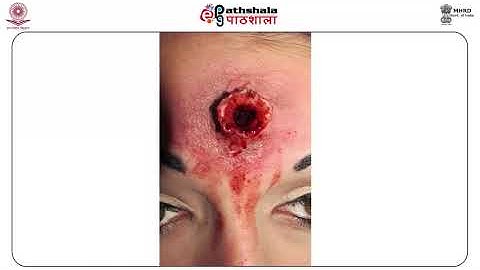 M-18. Terminal ballistics - Part II