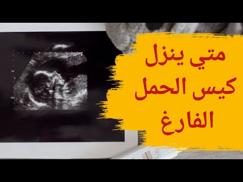 متى ينزل كيس الحمل الفارغ متى ينزل كيس الحمل الفارغ من تلقاء نفسه