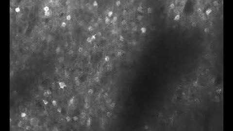 Neurons in the mouse brain