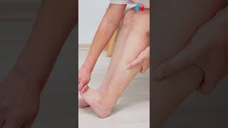 Is Your Leg Paining 1