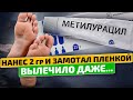 Вы ахнете узнав на что способна мазь Метилурацил!