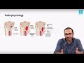 Marrow Master Classes: Orthopaedics Sample Video - Bone Infections - Pyogenic (20 mins)