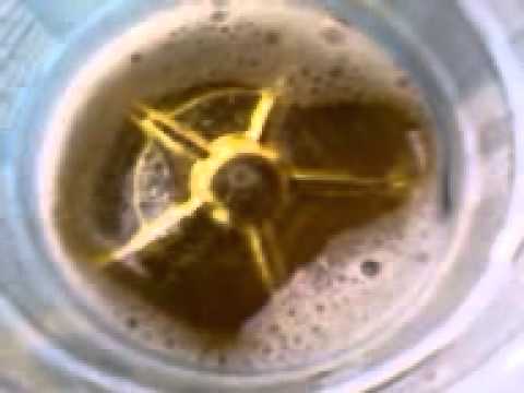 Yellow vaginal discharge throughout being pregnant diarrhea throughout past due being pregnant