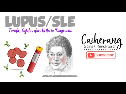 Video: Lupus Kulit - Penyebab, Gejala, Diagnosis, Dan Pengobatan Lupus Kulit