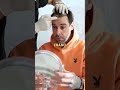 Trapianto Di Capelli | Testimonianza Del Paziente | Dermolife International