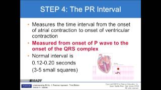 Basic EKG Chapter 6 Interpertation of the EKG Strip